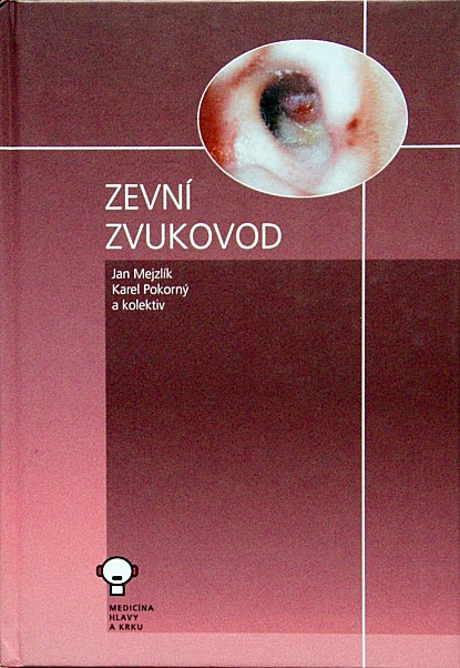 29288 Zevní zvukovod – Obrázok 1