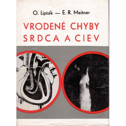 Vrodené chyby srdca a ciev