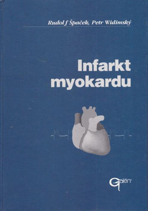 84749 Infarkt myokardu – Obrázok 1