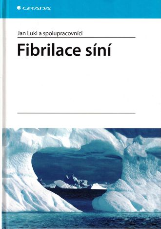 92530 Fibrilace síní – Obrázok 1