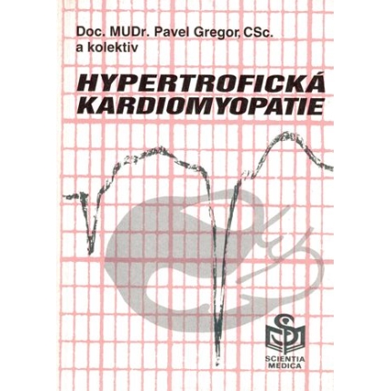 Hypertrofická kardiomyopatie