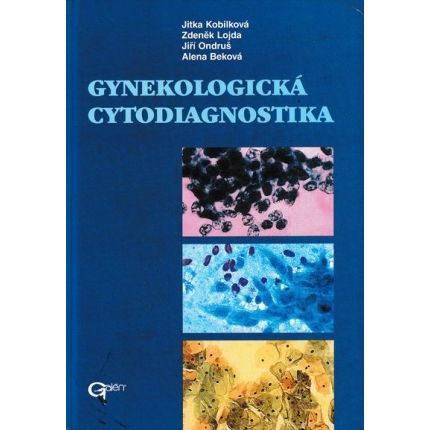 Gynekologická cytodiagnostika