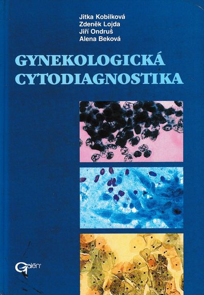 gynekologixka Gynekologická cytodiagnostika – Obrázok 1